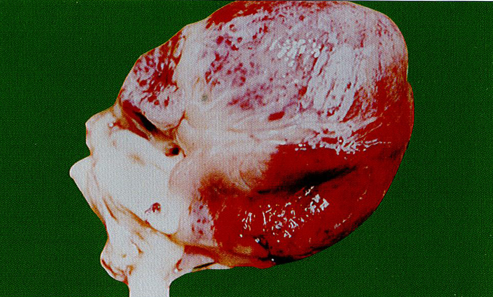 猪链球菌典型症状图片